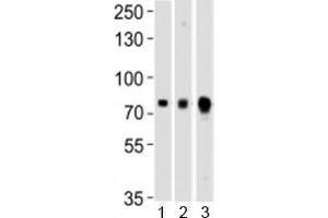 Western blot testing of Melk antibody at 1:1000 dilution and mouse 1) ovary, 2) spleen and 3) testis lysate
