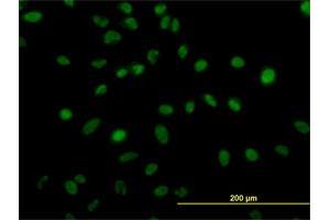 Immunofluorescence of monoclonal antibody to ZNF207 on HeLa cell.