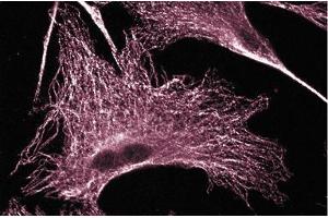 Immunofluorescence staining on 3T3-L1 cells (Mouse embryonic fibroblasts, ATCC CL-173).