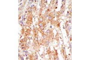 Image no. 2 for anti-Mitogen-Activated Protein Kinase Kinase Kinase 6 (MAP3K6) (C-Term) antibody (ABIN360297) (MAP3K6 anticorps  (C-Term))