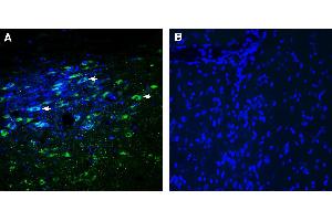 Expression of Glycine Receptor alpha 3 in rat substantia nigra pars compacta (SNC). (Gonadotropin-Releasing Hormone Receptor (GNRHR) Peptide)