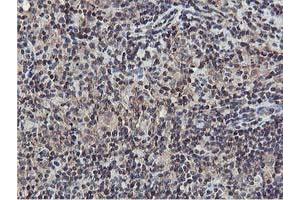 Image no. 6 for anti-V-Akt Murine Thymoma Viral Oncogene Homolog 1 (AKT1) antibody (ABIN1496555)