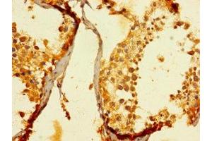Immunohistochemistry of paraffin-embedded human testis tissue using ABIN7151372 at dilution of 1:100 (ENTPD3 anticorps  (AA 60-338))
