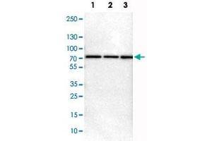 Western Blot analysis of Lane 1: NIH-3T3 cell lysate (mouse embryonic fibroblast cells), Lane 2: NBT-II cell lysate (Wistar rat bladder tumor cells) and Lane 3: PC12 cell lysate (pheochromocytoma of rat adrenal medulla) with PRKAG2 polyclonal antibody . (PRKAG2 anticorps)