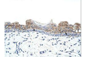 anti-Deleted in Azoospermia 2 (DAZ2) (AA 51-100) antibody