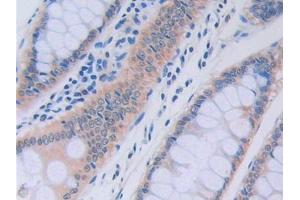 Used in DAB staining on fromalin fixed paraffin- embedded liver tissue (RNASE13 anticorps  (AA 20-156))