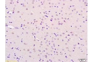 Formalin-fixed and paraffin embedded rat brain labeled with Anti-BCHE Polyclonal Antibody, Unconjugated (ABIN730603) at 1:200 followed by conjugation to the secondary antibody and DAB staining.