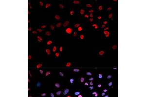 Immunofluorescence analysis of MCF-7 cells using Phospho-CREB1(S133) Polyclonal Antibody (CREB1 anticorps  (pSer133))