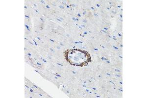 Immunohistochemistry of paraffin-embedded rat heart using Filamin A antibody (ABIN7267206) at dilution of 1:100 (40x lens). (Filamin A anticorps  (C-Term))