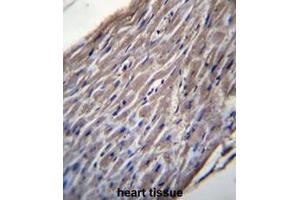 BVES Antibody (C-term) immunohistochemistry analysis in formalin fixed and paraffin embedded human heart tissue followed by peroxidase conjugation of the secondary antibody and DAB staining. (BVES anticorps  (C-Term))