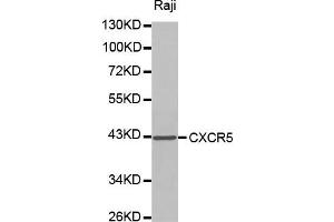 Western blot analysis of extracts of Raji cell lines, using CXCR5 antibody. (CXCR5 anticorps)