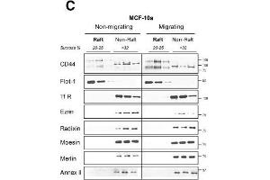 CD44 affiliation with lipid rafts is reduced during migration of highly-invasive breast cancer cells.