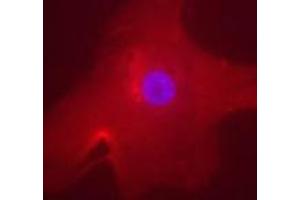 Immunofluorescent staining of MLXIPL in human hepatocyte using MLXIPL polyclonal antibody .