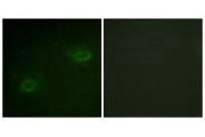 Immunofluorescence analysis of HeLa cells, using Syndecan4 (Ab-179) antibody. (SDC4 anticorps  (Ser179))