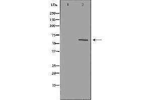 Western blot analysis of extracts of CEM, using CYP1B1 antibody. (CYP1B1 anticorps  (Internal Region))