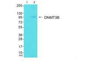 Western blot analysis of extracts from HuvEc cells (Lane 2), using DNMT3B antiobdy. (DNMT3B anticorps  (N-Term))