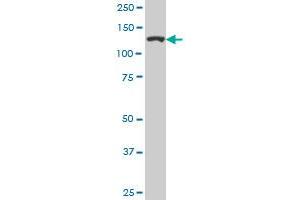 CAND1 monoclonal antibody (M05), clone 1G5. (CAND1 anticorps  (AA 1-100))