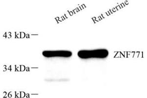 Western blot analysis of Znf771 (ABIN7076273)at dilution of 1: 500 (ZNF771 anticorps)