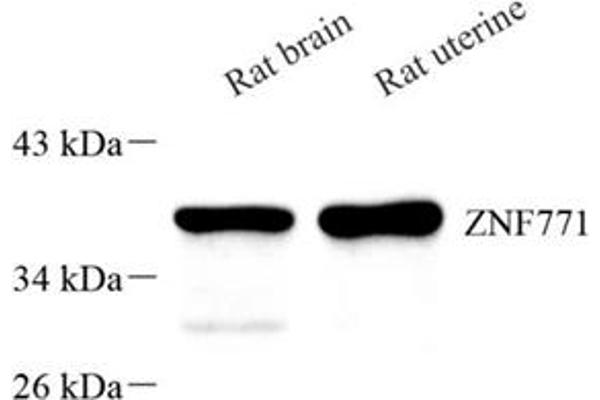 ZNF771 anticorps