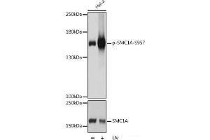Western blot analysis of extracts of HeLa cells using Phospho-SMC1A(S957) Polyclonal Antibody at dilution of 1:1000.