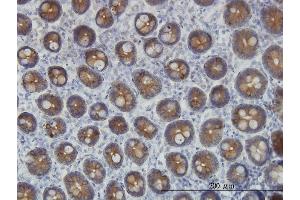 Immunoperoxidase of monoclonal antibody to KRT4 on formalin-fixed paraffin-embedded human small Intestine. (KRT4 anticorps  (AA 194-300))