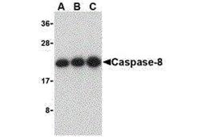 Western Blotting (WB) image for anti-Caspase 8 (CASP8) (C-Term) antibody (ABIN2477922) (Caspase 8 anticorps  (C-Term))