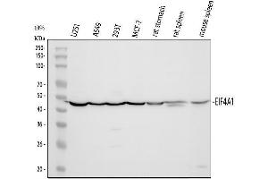 Western blot analysis of EIF4A1 using anti-EIF4A1 antibody (ABIN7603125).