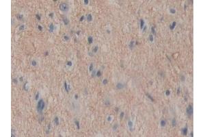 Detection of ENPEP in Human Glioma Tissue using Polyclonal Antibody to Aminopeptidase A (ENPEP)