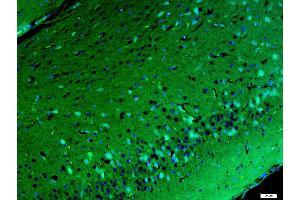 Paraformaldehyde-fixed, paraffin embedded Mouse brain, Antigen retrieval by boiling in sodium citrate buffer (pH6.