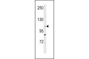 Western blot analysis of C14orf145 Antibody (Center) (ABIN652929 and ABIN2842595) in HL-60 cell line lysates (35 μg/lane).