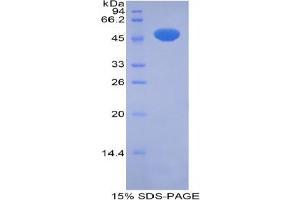 SDS-PAGE analysis of Rat Pregnane X Receptor Protein. (NR1I2 Protéine)
