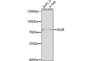 Western blot analysis of extracts of various cell lines, using  antibody (ABIN7265697) at 1:1000 dilution. (ALG9 anticorps  (AA 439-618))
