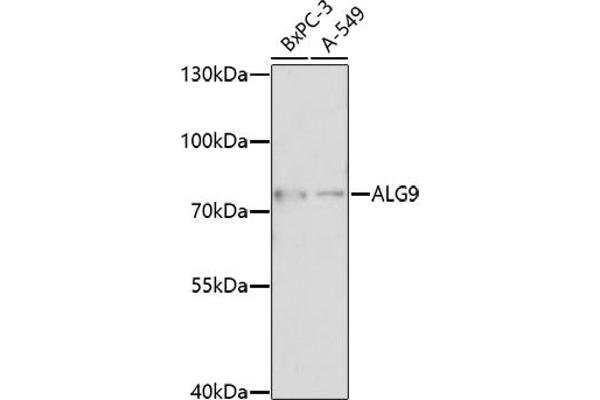 ALG9 anticorps  (AA 439-618)