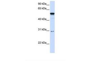 Image no. 1 for anti-Autoimmune Regulator (AIRE) (AA 218-267) antibody (ABIN6737664) (AIRE anticorps  (AA 218-267))