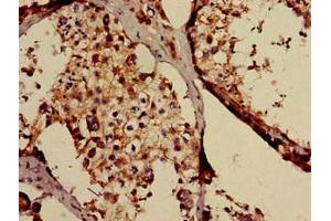 Immunohistochemistry of paraffin-embedded human testis tissue using ABIN7171472 at dilution of 1:100 (TAF6L anticorps  (AA 345-433))