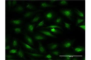 Immunofluorescence of monoclonal antibody to ZBTB7A on HeLa cell. (ZBTB7A anticorps  (AA 1-108))