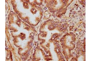 IHC image of ABIN7153733 diluted at 1:400 and staining in paraffin-embedded human prostate tissue performed on a Leica BondTM system.