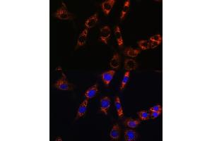 Immunofluorescence analysis of NIH/3T3 cells using  Rabbit pAb (ABIN6133587, ABIN6137053, ABIN6137054 and ABIN6224632) at dilution of 1:100.