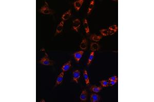 Immunofluorescence analysis of NIH/3T3 cells using  Rabbit pAb (ABIN6133587, ABIN6137053, ABIN6137054 and ABIN6224632) at dilution of 1:100. (Aquaporin 8 anticorps  (AA 50-150))
