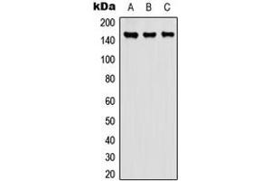 Western blot analysis of Carboxypeptidase D expression in A549 (A), NS-1 (B), PC12 (C) whole cell lysates.