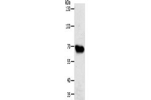 Western Blotting (WB) image for anti-ATP-Binding Cassette, Sub-Family G (WHITE), Member 1 (ABCG1) antibody (ABIN2426499) (ABCG1 anticorps)