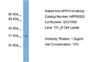 WB Suggested Anti-SPRY3  Antibody Titration: 0. (SPRY3 anticorps  (N-Term))