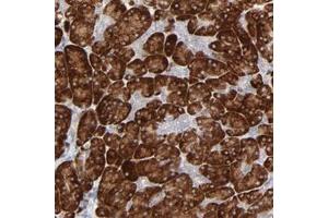 Immunohistochemical staining of human pancreas with FANCB polyclonal antibody  shows strong cytoplasmic positivity in exocrine glandular cells. (FANCB anticorps)