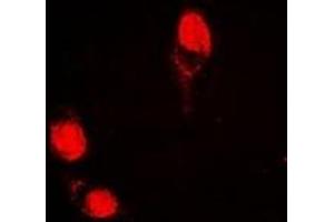 Immunofluorescent analysis of AGFG1 staining in HepG2 cells. (AGFG1 anticorps)