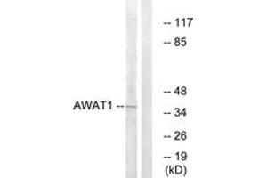 Western blot analysis of extracts from 293 cells, using AWAT1 Antibody. (AWAT1 anticorps  (AA 261-310))