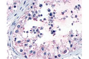Anti-GPR149 antibody IHC of human testis, seminiferous epithelium.