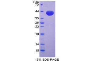 SDS-PAGE (SDS) image for Chemokine (C-C Motif) Ligand 14 (CCL14) (AA 20-93) protein (His tag,GST tag) (ABIN1980894)