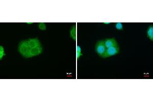 ICC/IF Image StAR antibody detects StAR protein at mitochondria by immunofluorescent analysis. (STAR anticorps)