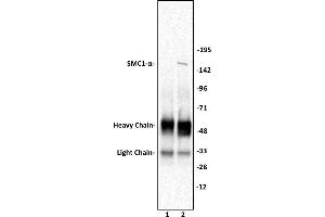 SMC1- a antibody (pAb) tested by Immunoprecipitation. (SMC1A anticorps  (C-Term))
