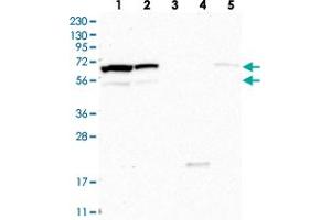 Western blot analysis of Lane 1: RT-4, Lane 2: U-251 MG, Lane 3: Human Plasma, Lane 4: Liver, Lane 5: Tonsil with CPSF3L polyclonal antibody .